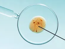 Imagem ilustrativa de uma fertilização in vitro