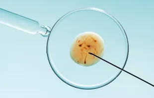 Imagem ilustrativa de uma fertilização in vitro