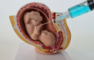 Imagem ilustrativa de uma assistolia fetal