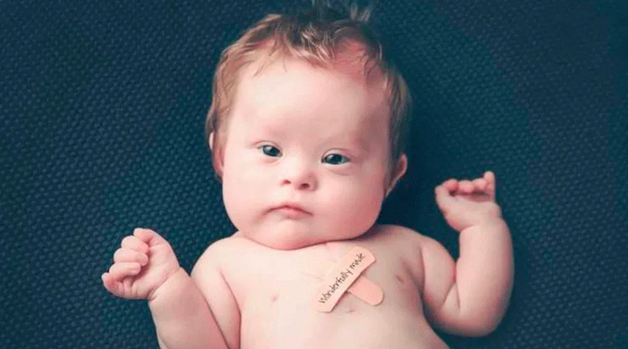 Este bebê com síndrome de Down foi curado pela intercessão do fundador